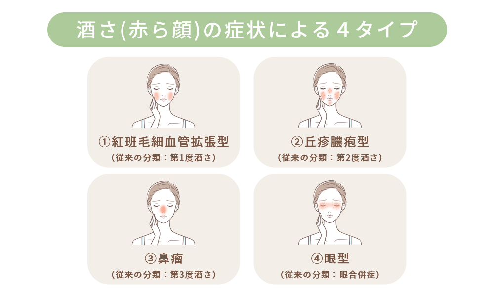 酒さ（赤ら顔）の症状による4タイプ