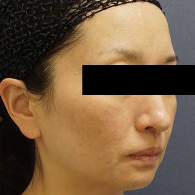Before image