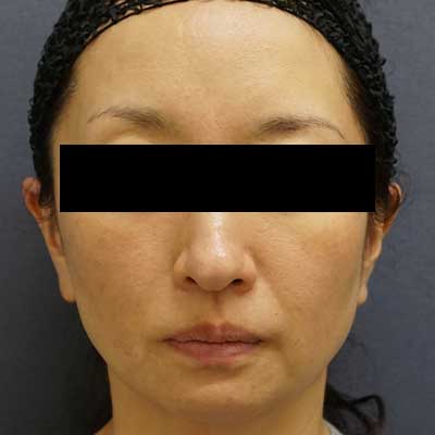 Before image