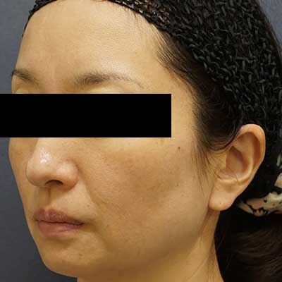 Before image