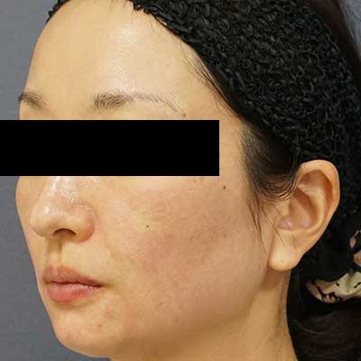 After image