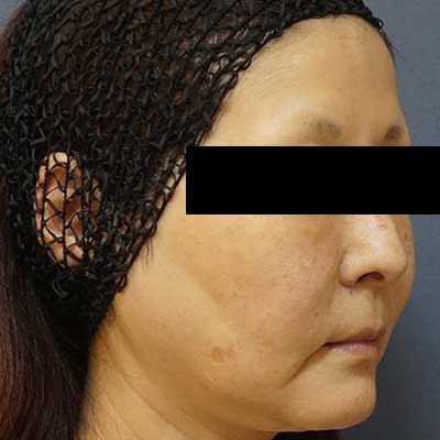 Before image