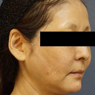 After image