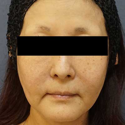 Before image