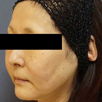 Before image