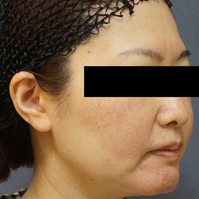 Before image