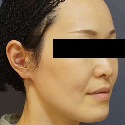 Before image