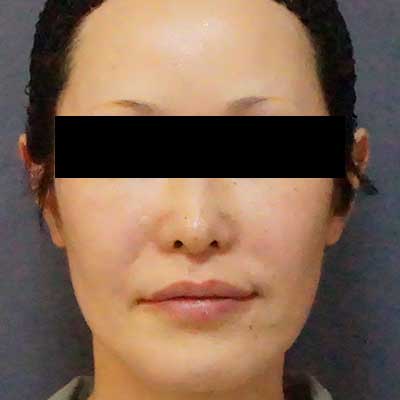 After image