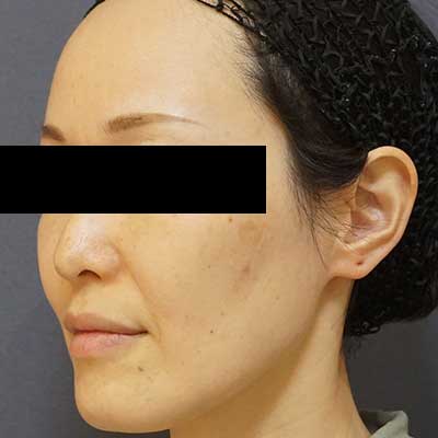 Before image