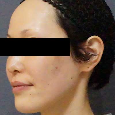After image