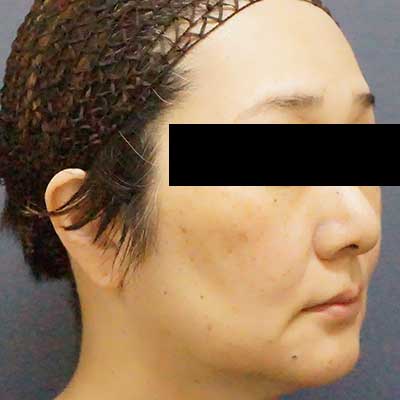 Before image
