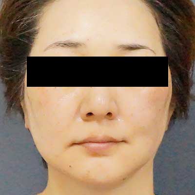 After image