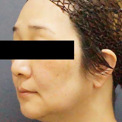 Before image