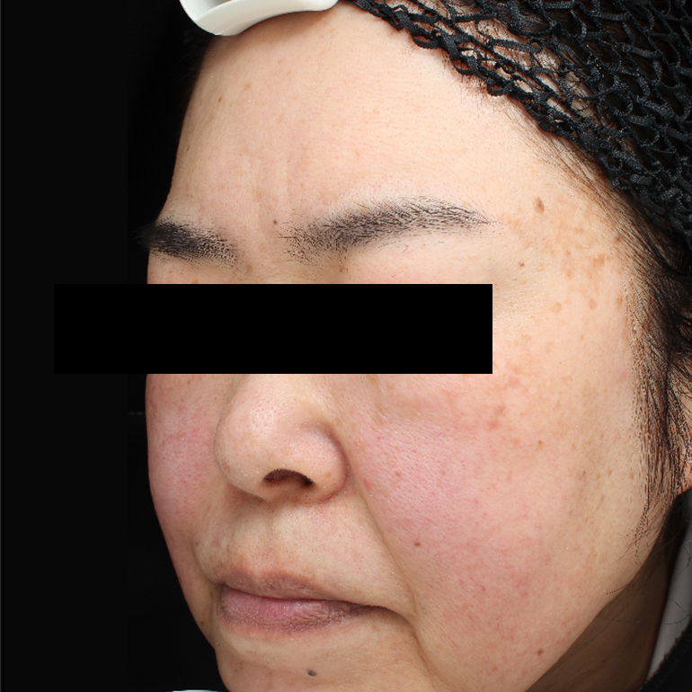 Before image