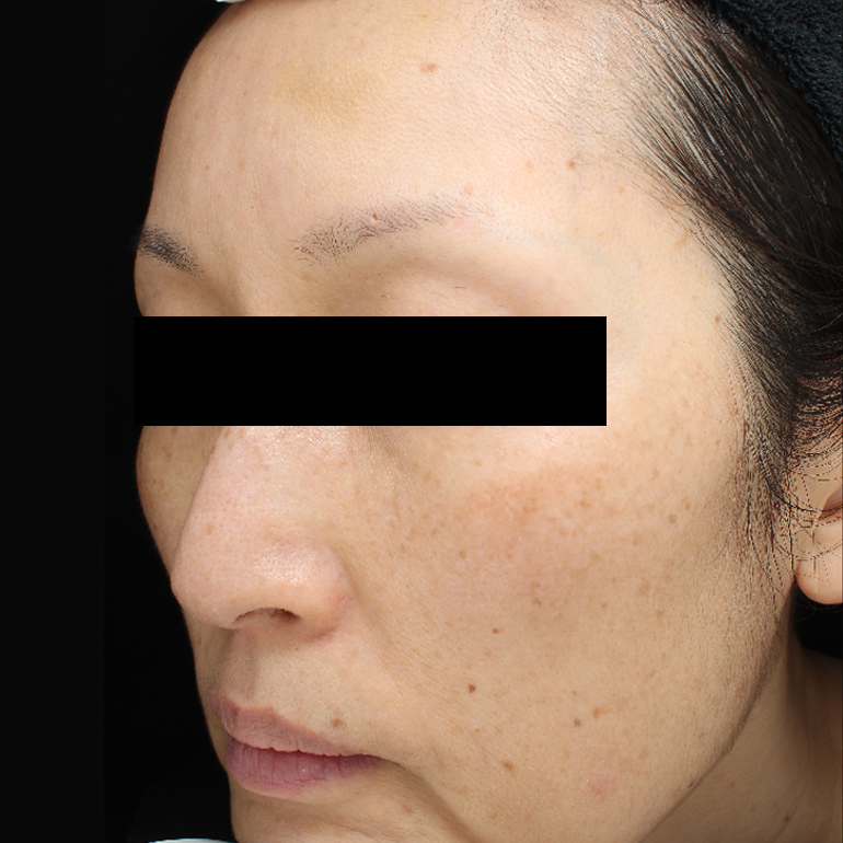 Before image