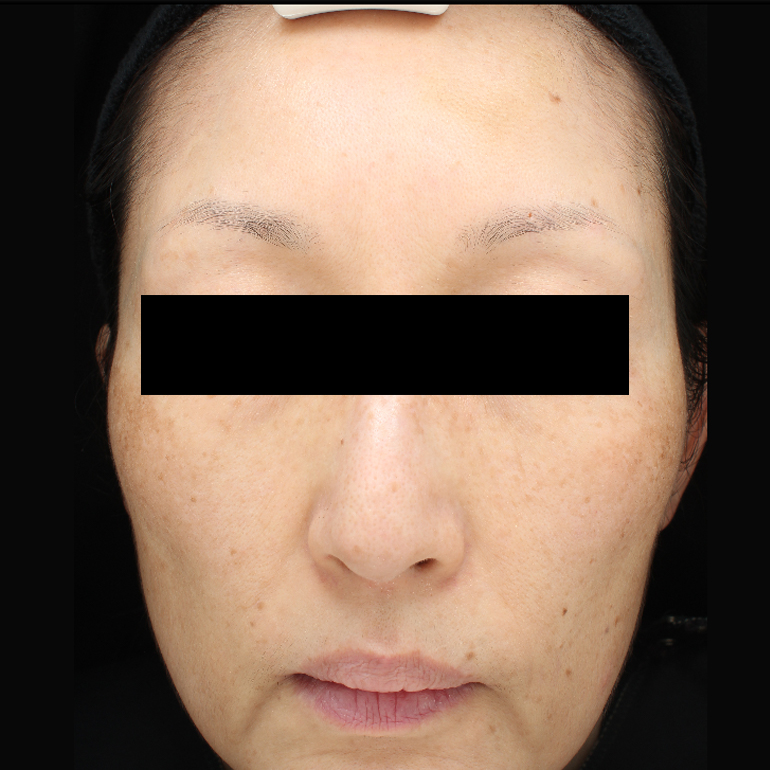 Before image