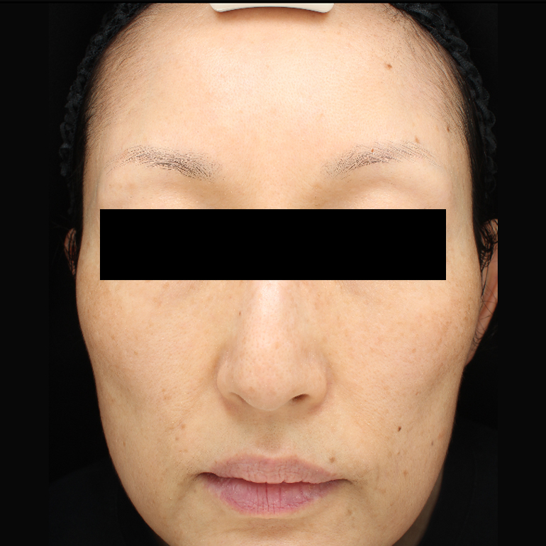 After image