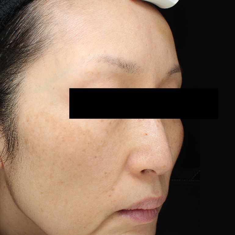 Before image