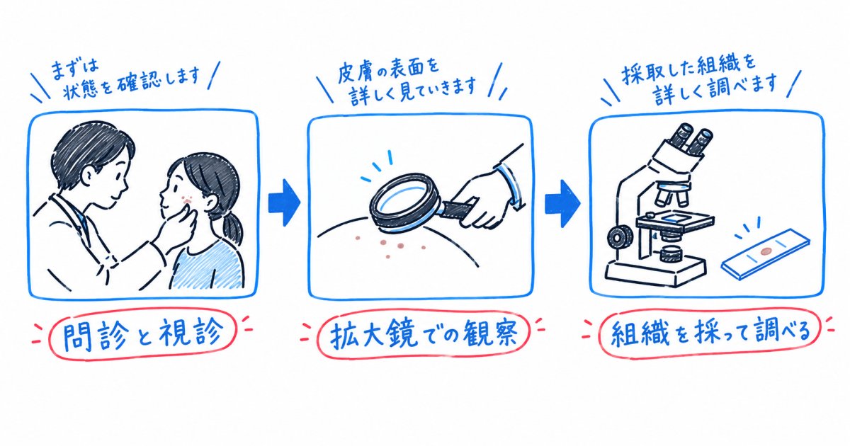 皮膚科で行われる検査の流れ(視診・拡大鏡検査・組織検査)