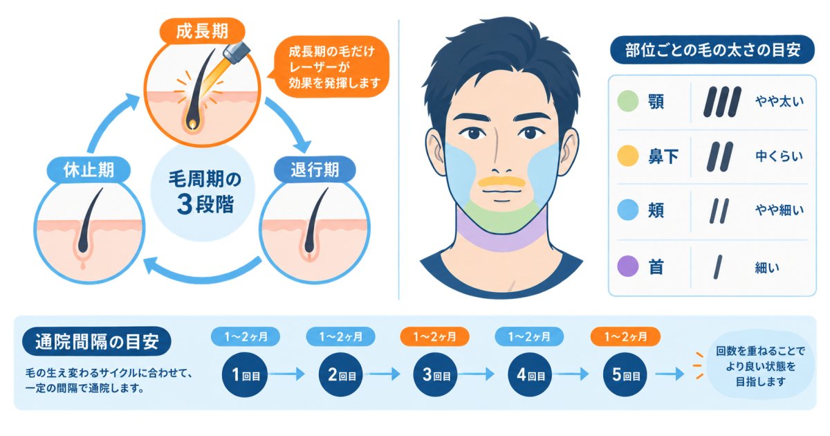 効果が出るまでの回数と期間—部位ごとの毛質による違い